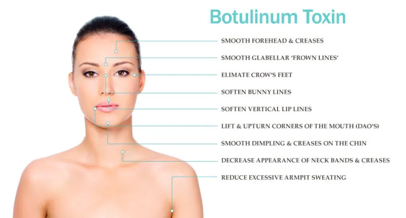 Slimming Anti Wrinkle Beutox Batulaxs Resty Dermal Filler Juvederms 0